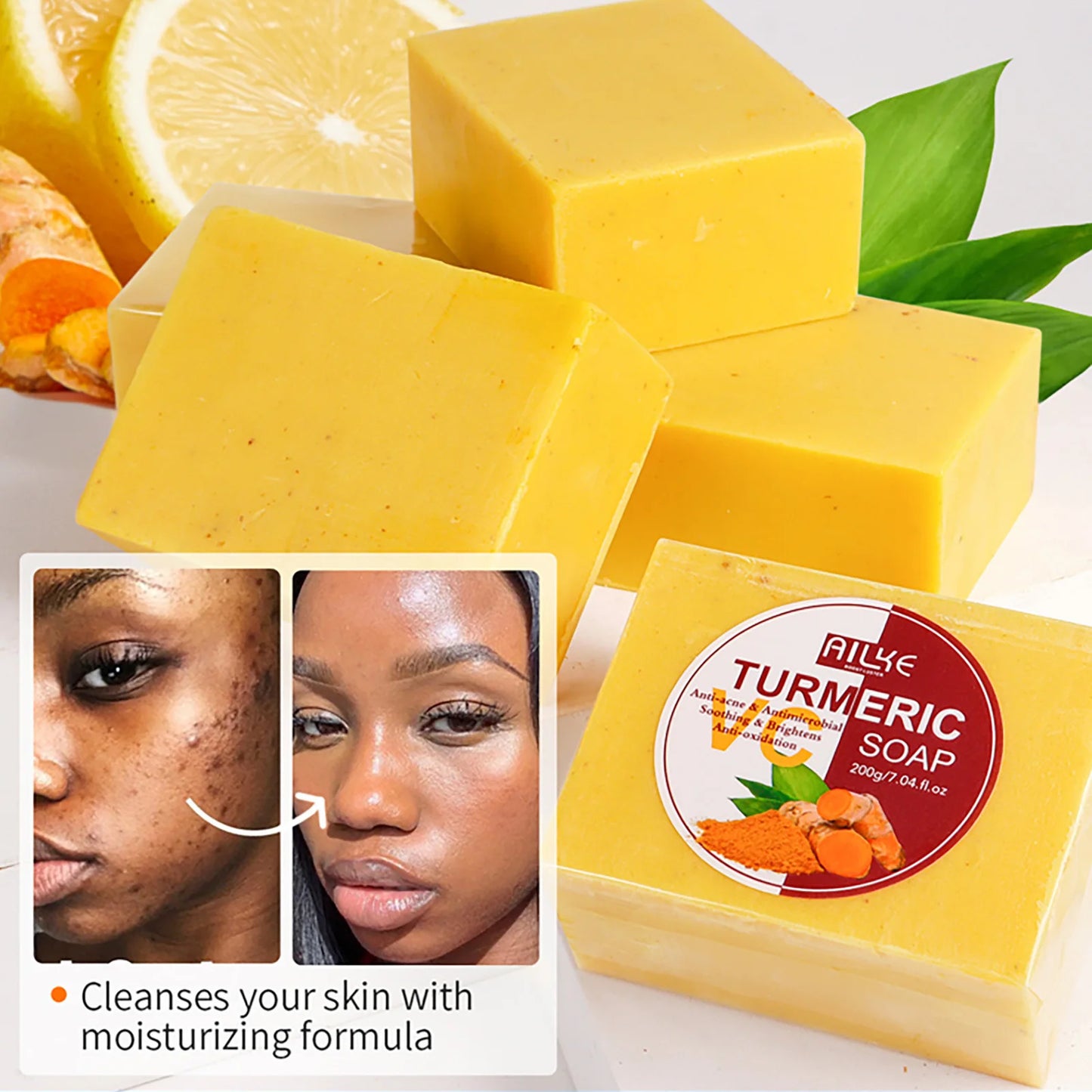 Organic Turmeric Soap, Clean Stain, Radiant Skin, Soothing Brighten, Smooth, Natural Soft Skin Bar, 200g/ 7.04. oz